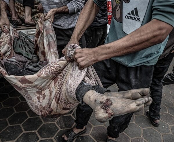 Numri i vdekjeve nga sulmet izraelite në Gaza rritet në&hellip;