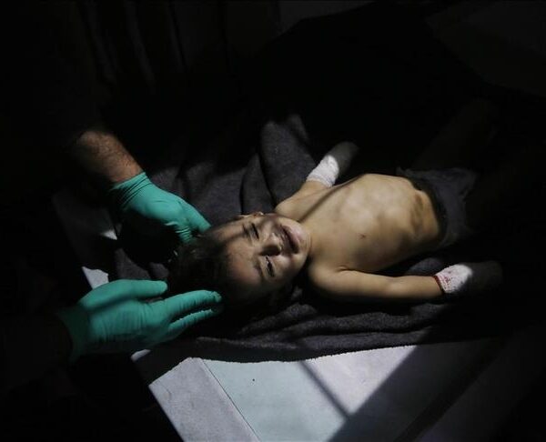 Gaza, numri i palestinezëve të vrarë nga ofensiva vdekjeprurëse e&hellip;
